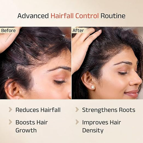Keshamruth Herb Oil + Dhavath Hairfall Shampoo + Vithan Pro serum
